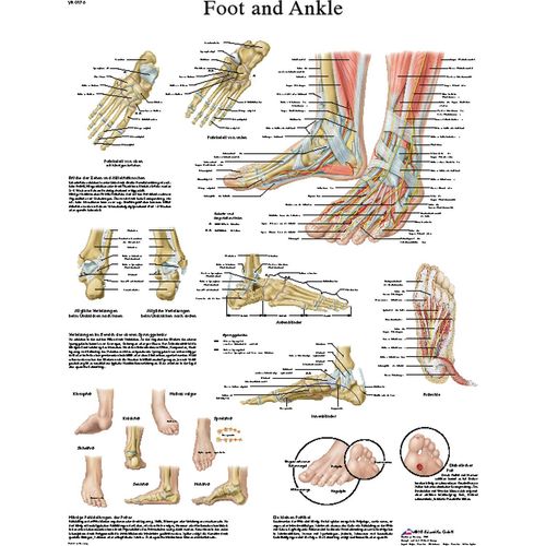 Anatomical Chart - foot & ankle, laminated (4R321) | Direct Supply